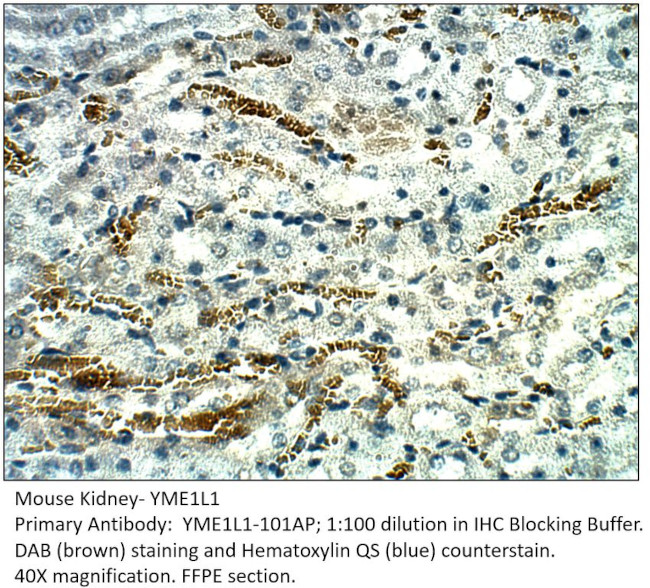 YME1L1 Antibody in Immunohistochemistry (IHC)