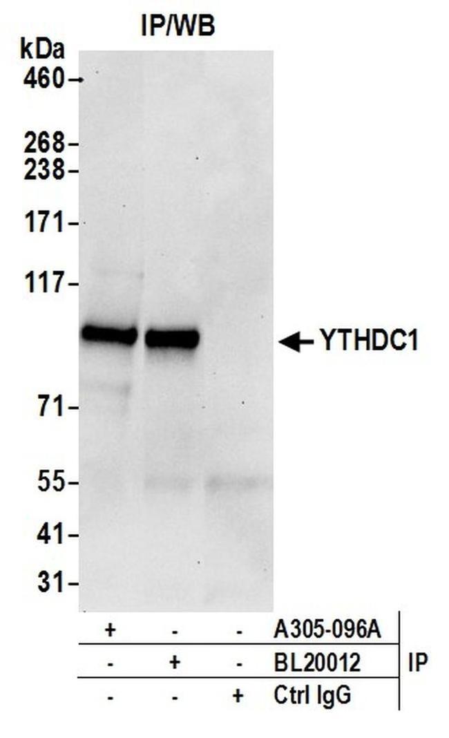 YTHDC1/YT521 Antibody in Western Blot (WB)