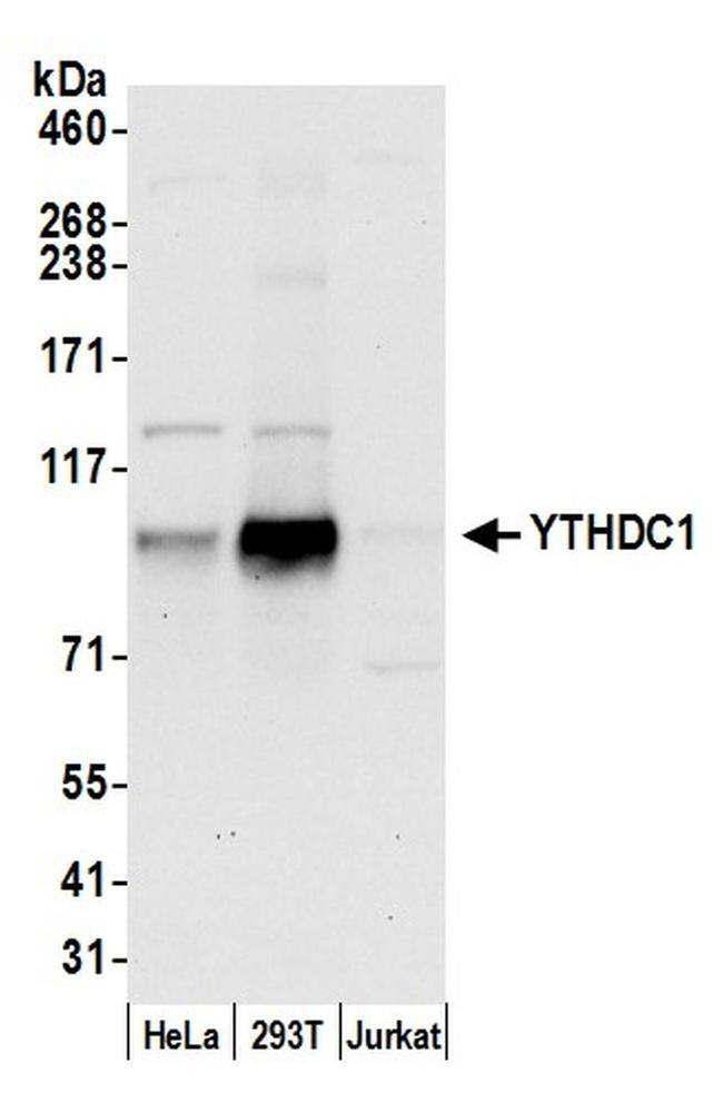 YTHDC1/YT521 Antibody in Western Blot (WB)