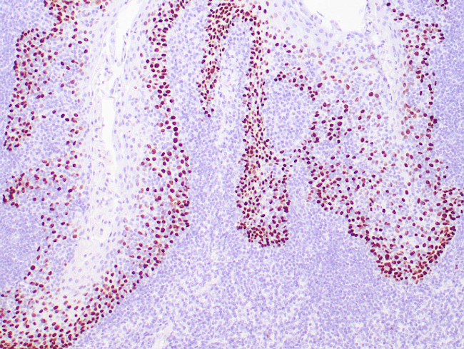 p40 Antibody in Immunohistochemistry (Paraffin) (IHC (P))