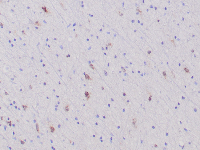 IDH1 (mutant R132H) Antibody in Immunohistochemistry (Paraffin) (IHC (P))