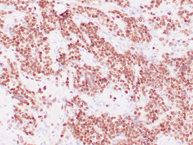 Myogenin Antibody in Immunohistochemistry (Paraffin) (IHC (P))