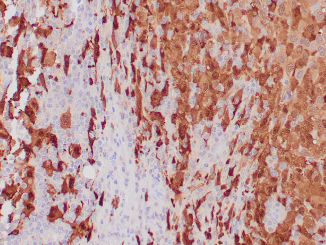 S-100 Antibody in Immunohistochemistry (Paraffin) (IHC (P))