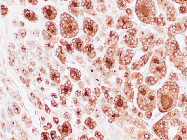 Thyroglobulin Antibody in Immunohistochemistry (Paraffin) (IHC (P))