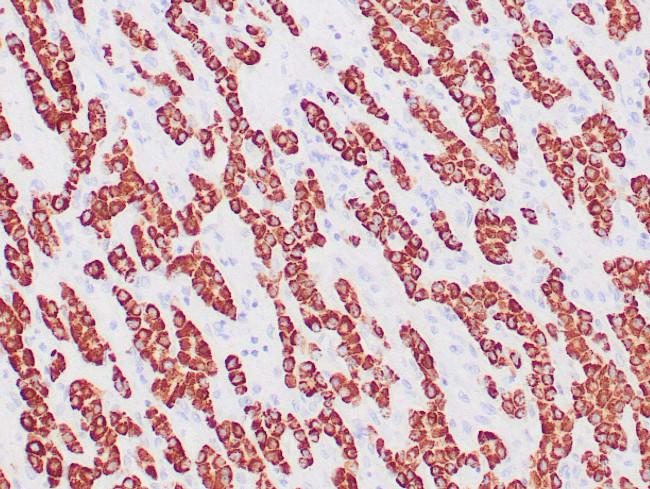 HepPar-1 Antibody in Immunohistochemistry (Paraffin) (IHC (P))