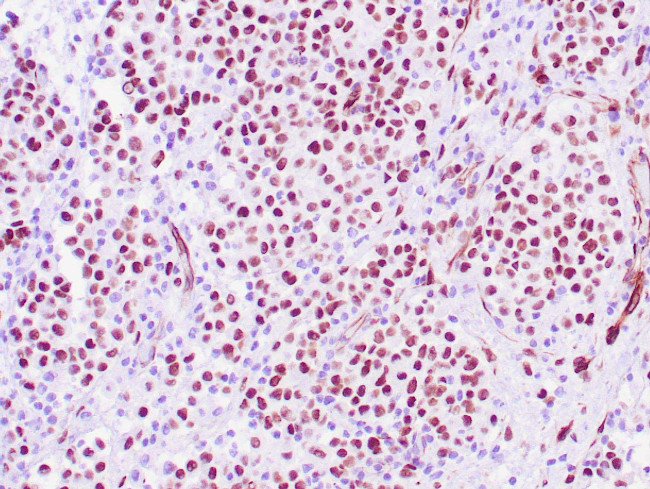 WT-1 Antibody in Immunohistochemistry (Paraffin) (IHC (P))