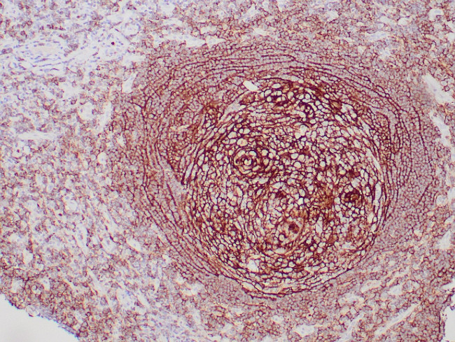 CD35 Antibody in Immunohistochemistry (Paraffin) (IHC (P))