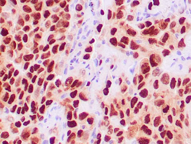 TTF-1/NKX2.1 Antibody in Immunohistochemistry (Paraffin) (IHC (P))