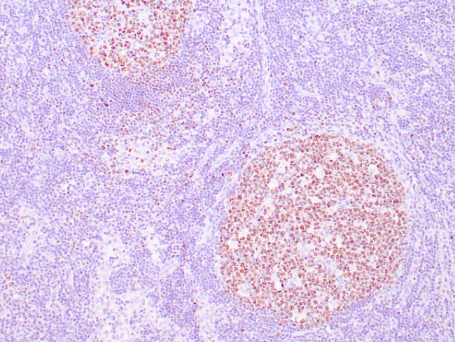 OCT-2 Antibody in Immunohistochemistry (Paraffin) (IHC (P))