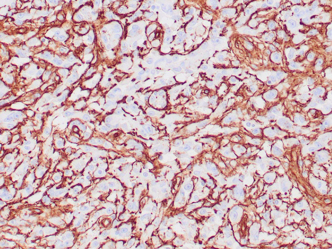 Collagen IV Antibody in Immunohistochemistry (Paraffin) (IHC (P))