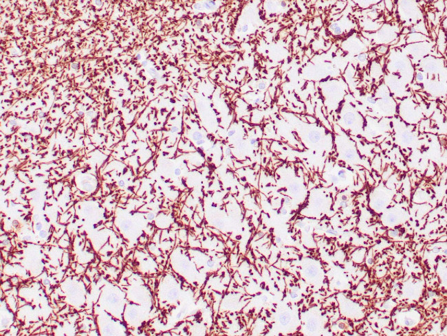 Myelin basic protein Antibody in Immunohistochemistry (Paraffin) (IHC (P))