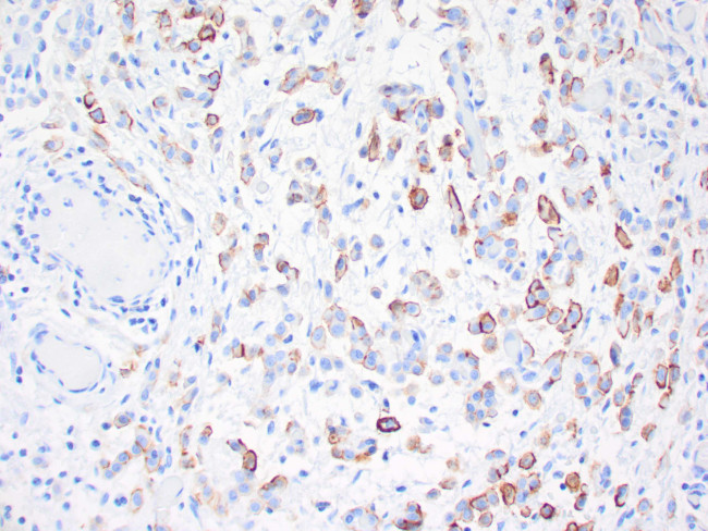 Thrombomodulin / CD141 Antibody in Immunohistochemistry (Paraffin) (IHC (P))