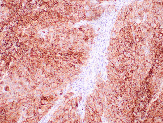 GLUT-1 Antibody in Immunohistochemistry (Paraffin) (IHC (P))