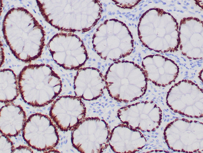 SATB2 Antibody in Immunohistochemistry (Paraffin) (IHC (P))