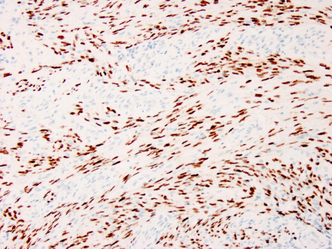 HHV-8 Antibody in Immunohistochemistry (Paraffin) (IHC (P))