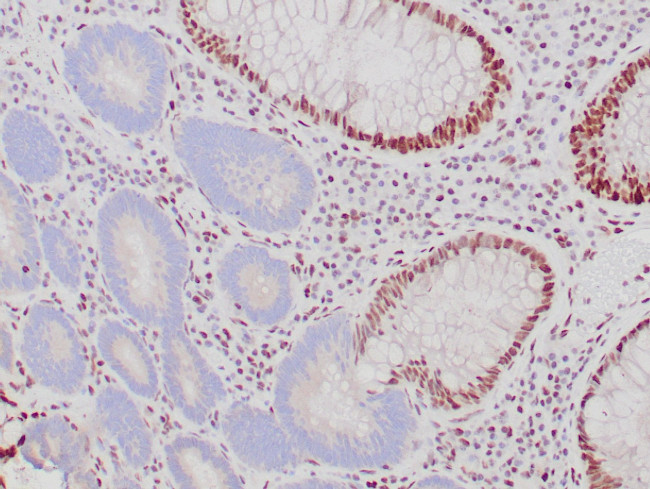 MSH2 Antibody in Immunohistochemistry (Paraffin) (IHC (P))