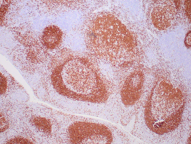 PAX-5 Antibody in Immunohistochemistry (Paraffin) (IHC (P))