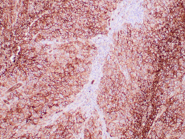 GLUT-1 Antibody in Immunohistochemistry (Paraffin) (IHC (P))