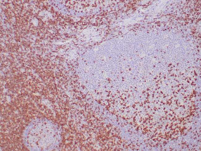 CD2 Antibody in Immunohistochemistry (Paraffin) (IHC (P))