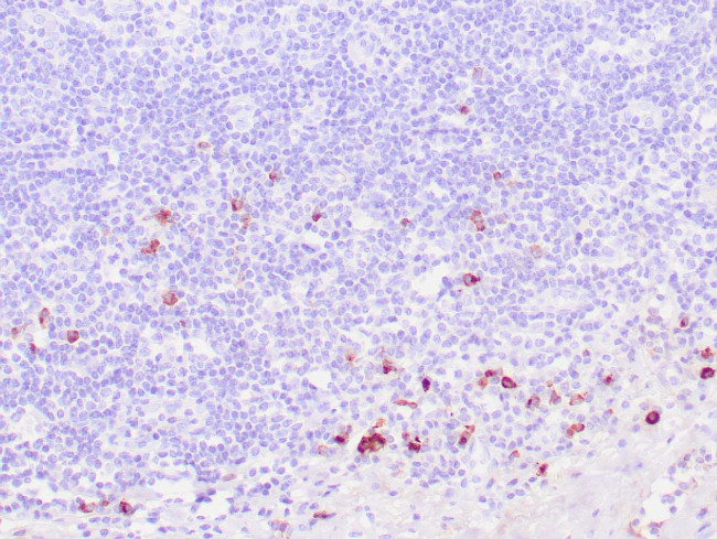 IgG4 Antibody in Immunohistochemistry (Paraffin) (IHC (P))