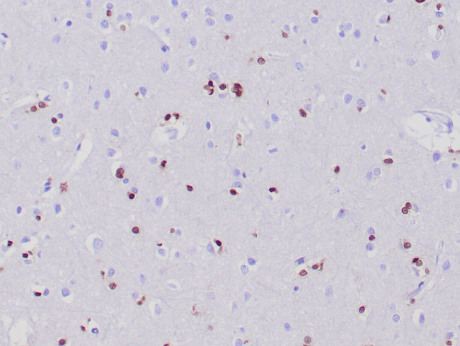 Olig2 Antibody in Immunohistochemistry (Paraffin) (IHC (P))