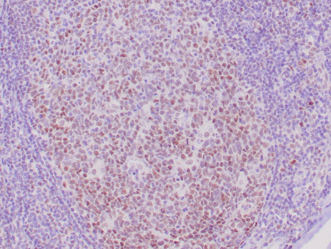 Rb Antibody in Immunohistochemistry (Paraffin) (IHC (P))