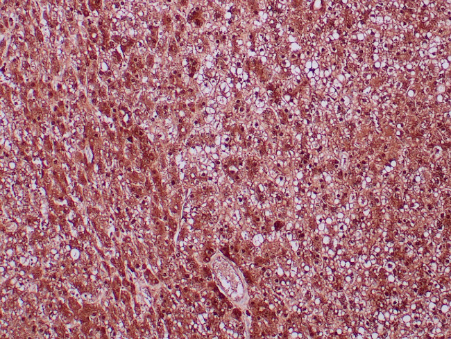 Arginase-1 Antibody in Immunohistochemistry (Paraffin) (IHC (P))