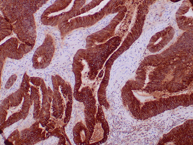 CEA Antibody in Immunohistochemistry (Paraffin) (IHC (P))