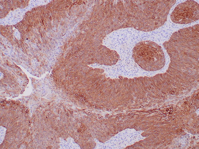 Cytokeratin 14 Antibody in Immunohistochemistry (Paraffin) (IHC (P))