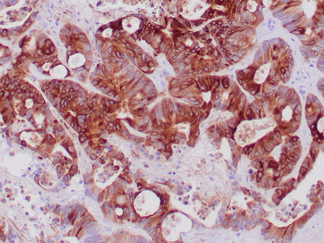 EMA Antibody in Immunohistochemistry (Paraffin) (IHC (P))