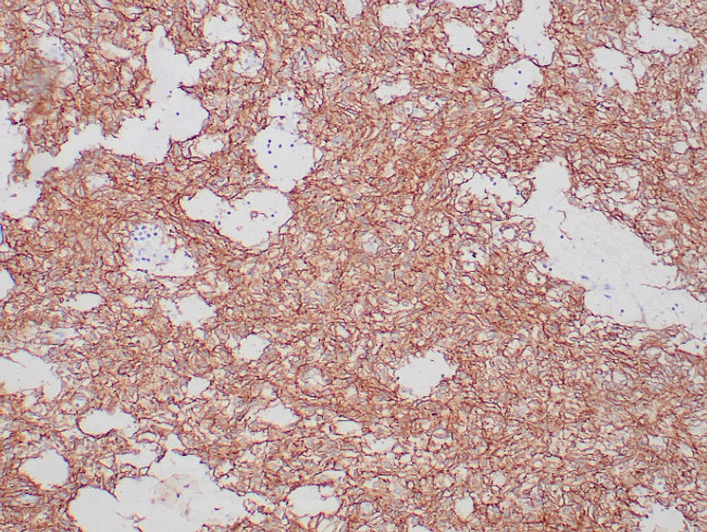 DOG1 Antibody in Immunohistochemistry (Paraffin) (IHC (P))