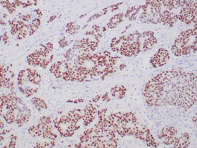 ER Antibody in Immunohistochemistry (Paraffin) (IHC (P))