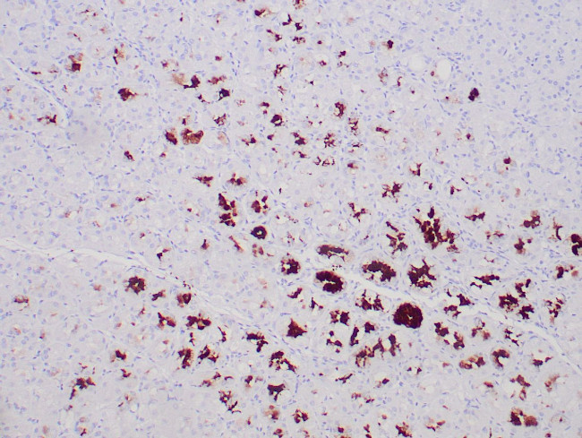 MUC-5AC Antibody in Immunohistochemistry (Paraffin) (IHC (P))