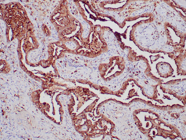 Napsin A Antibody in Immunohistochemistry (Paraffin) (IHC (P))