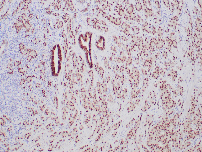 NKX3.1 Antibody in Immunohistochemistry (Paraffin) (IHC (P))