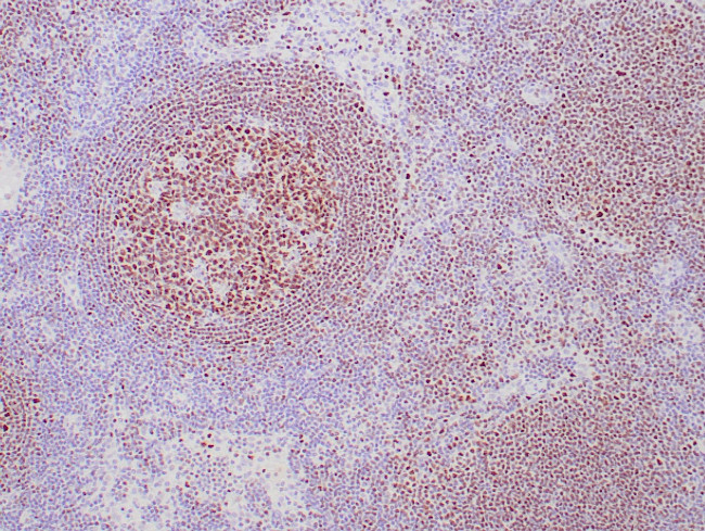 OCT-2 Antibody in Immunohistochemistry (Paraffin) (IHC (P))