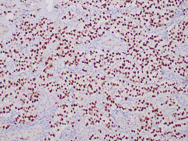 SALL4 Antibody in Immunohistochemistry (Paraffin) (IHC (P))