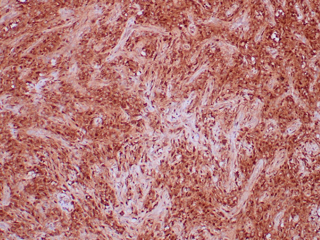 STAT6 Antibody in Immunohistochemistry (Paraffin) (IHC (P))