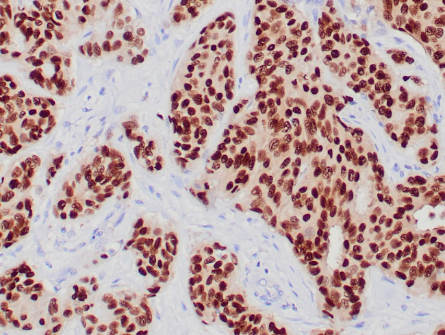 PR Antibody in Immunohistochemistry (Paraffin) (IHC (P))