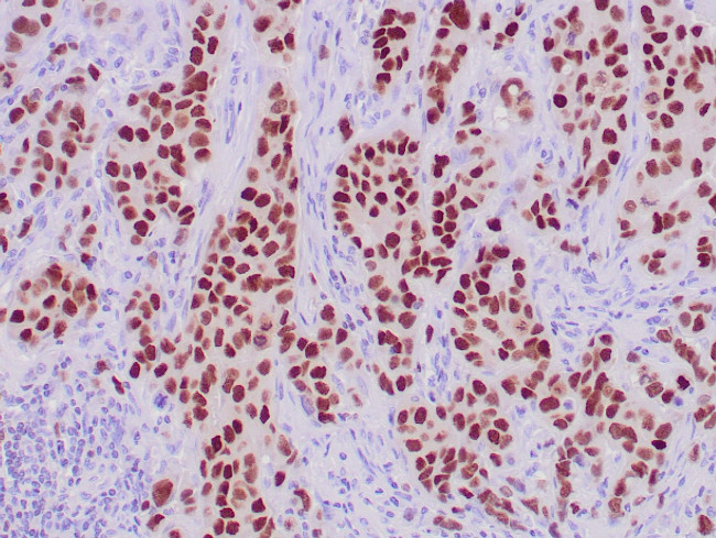 GATA3 Antibody in Immunohistochemistry (Paraffin) (IHC (P))