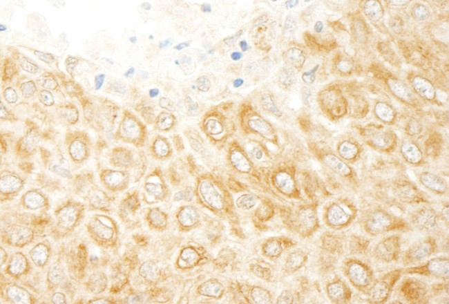 ZAK Antibody in Immunohistochemistry (IHC)