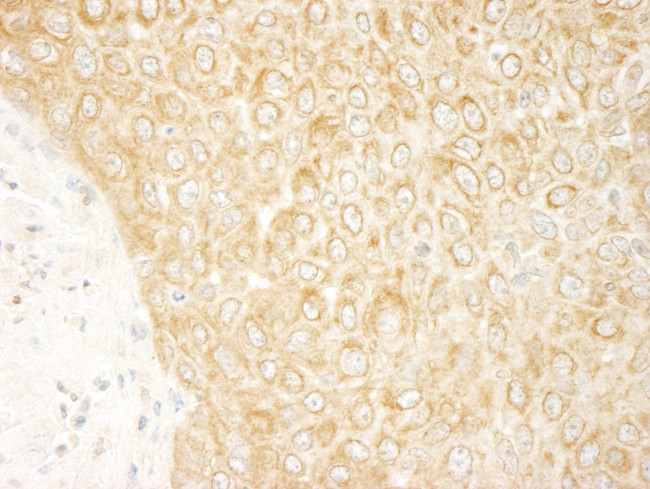 ZAK Antibody in Immunohistochemistry (IHC)