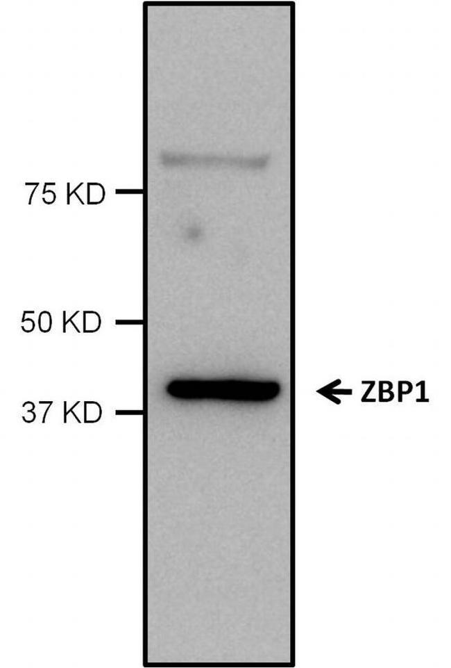 ZBP1 Antibody in Western Blot (WB)