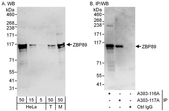 ZBP89 Antibody in Western Blot (WB)