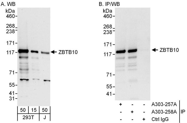 ZBTB10 Antibody in Western Blot (WB)
