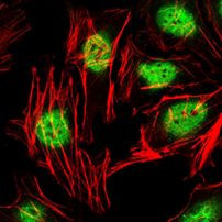 PLZF Antibody in Immunocytochemistry (ICC/IF)