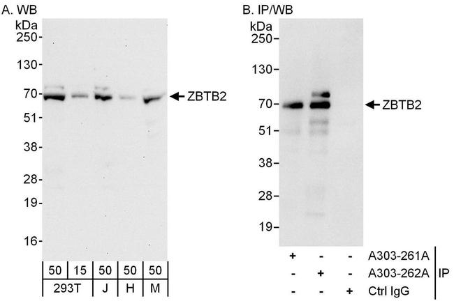 ZBTB2 Antibody in Western Blot (WB)