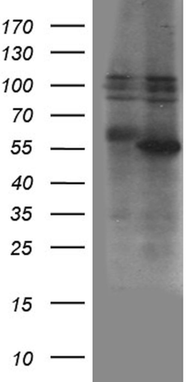 ZBTB32 Antibody in Western Blot (WB)