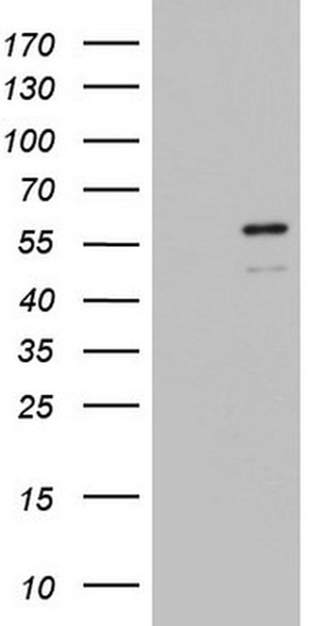ZBTB37 Antibody in Western Blot (WB)