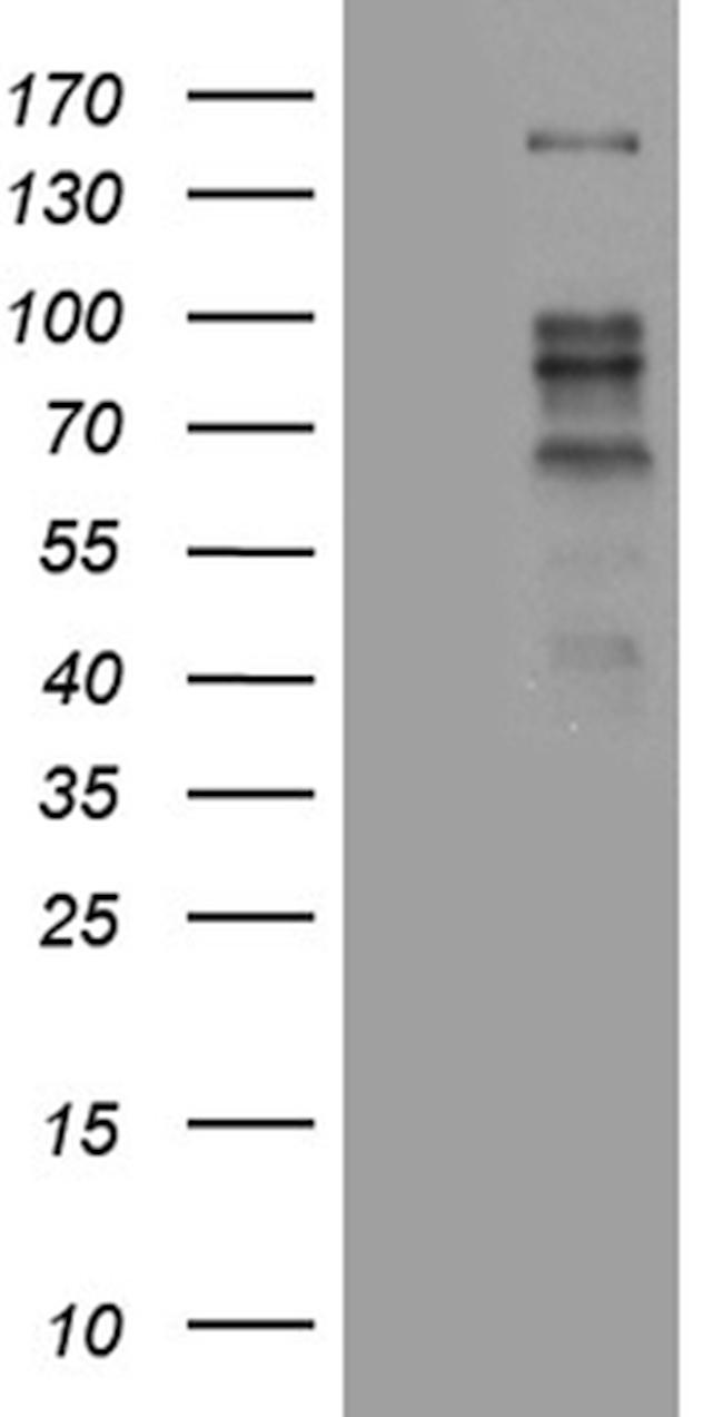 ZBTB4 Antibody in Western Blot (WB)